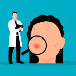 Acne giovanile e dell’adulto: cure, laser e impatto psicologico. Quando e come intervenire