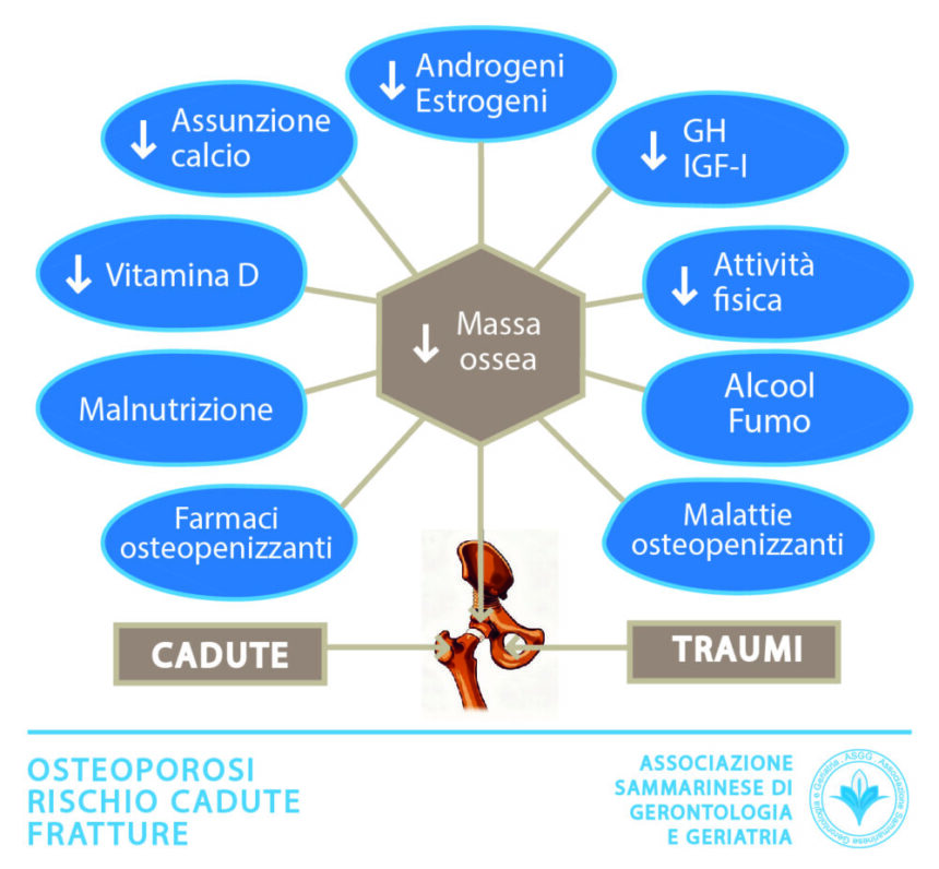 San Marino – Master in medicina geriatrica: Osteoporosi, rischio cadute e fratture nell’anziano