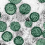 Hantavirus. I protocolli a San Marino ci sono?